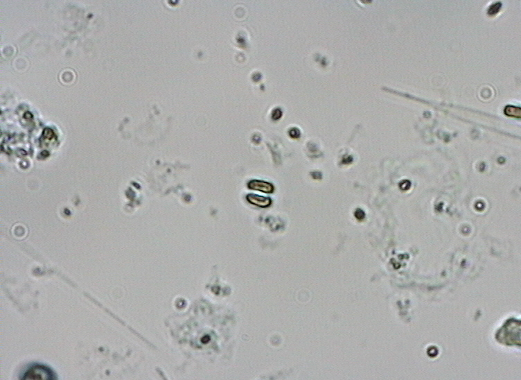 Dictyocha speculum